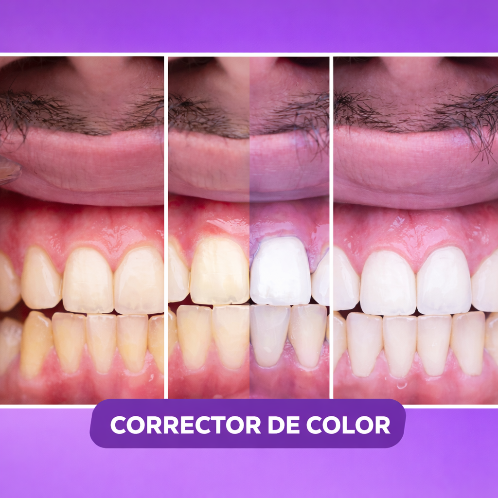 Blanqueador V34 Brildent