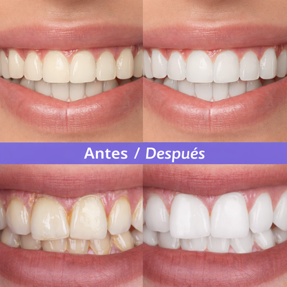 Tiras blanqueadoras con tecnología violeta v34